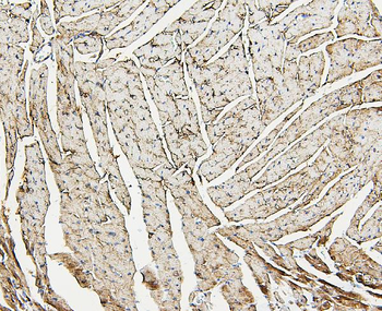 Anti-Aldolase/ALDOA Antibody