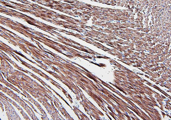 Anti-Aldolase/ALDOA Antibody