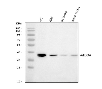 Anti-Aldolase/ALDOA Antibody