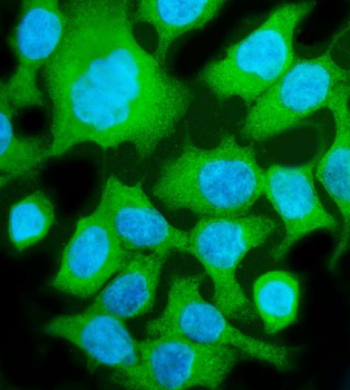 Anti-Aldolase/ALDOB Antibody