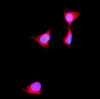 Anti-Aldolase/ALDOB Antibody