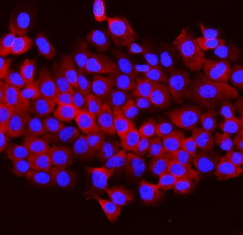 Anti-Aldolase/ALDOB Antibody