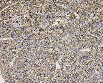 Anti-Aldolase/ALDOB Antibody