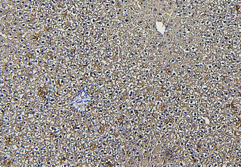 Anti-Aldolase/ALDOB Antibody