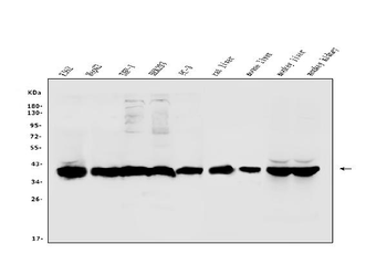 Anti-Aldolase/ALDOB Antibody
