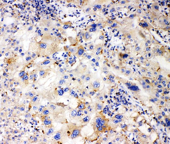 Anti-Apolipoprotein L1/APOL1 Antibody