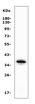 Anti-Apolipoprotein L1/APOL1 Antibody