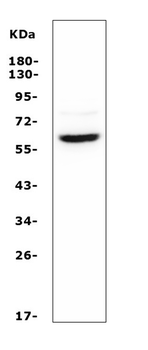 ASIC1 Rabbit Polyclonal Antibody