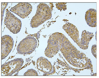 Anti-BubR1/BUB1B Antibody