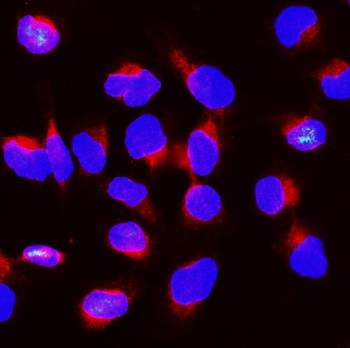 Anti-BubR1/BUB1B Antibody