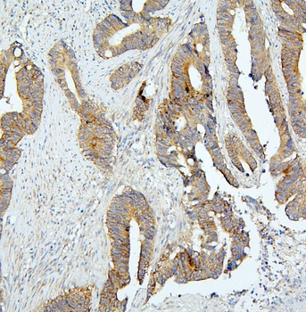 Anti-BubR1/BUB1B Antibody