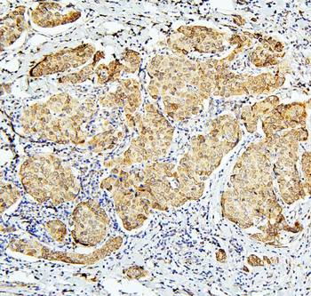 Anti-BubR1/BUB1B Antibody