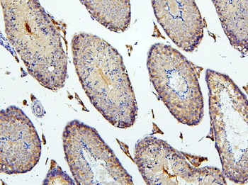 Anti-BubR1/BUB1B Antibody