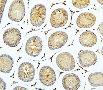 Anti-BubR1/BUB1B Antibody