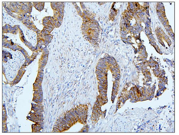 Anti-BubR1/BUB1B Antibody