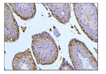 Anti-BubR1/BUB1B Antibody