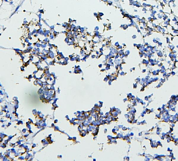 Anti-CETP Antibody
