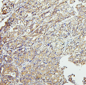 Anti-CETP Antibody