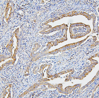 Anti-CETP Antibody