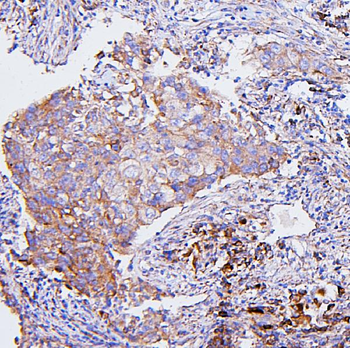 Anti-CETP Antibody