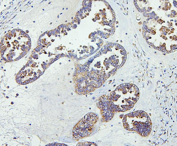 Anti-CETP Antibody