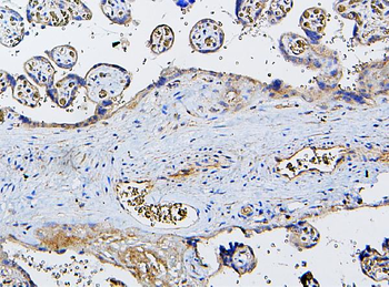 Anti-CETP Antibody
