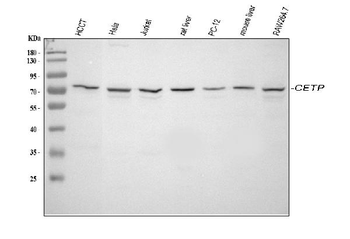 Anti-CETP Antibody