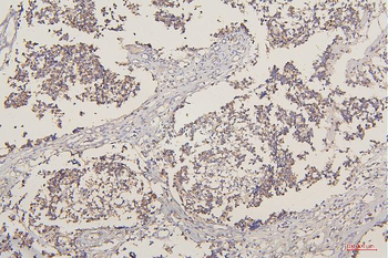 Anti-TORC1/CRTC1 Antibody