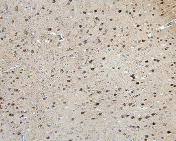 Anti-TORC1/CRTC1 Antibody