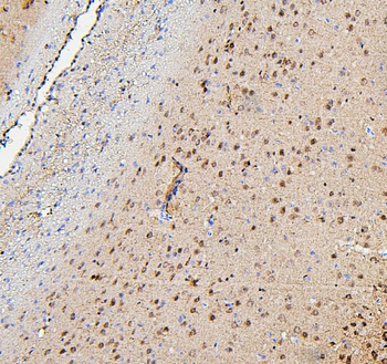 Anti-TORC1/CRTC1 Antibody
