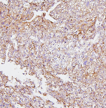 Anti-Cytochrome P450 2E1/CYP2E1 Antibody
