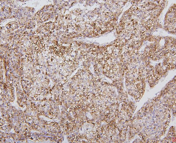 Anti-Cytochrome P450 2E1/CYP2E1 Antibody
