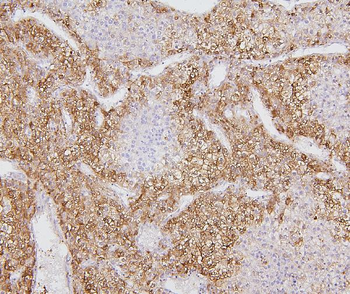 Anti-Cytochrome P450 2E1/CYP2E1 Antibody