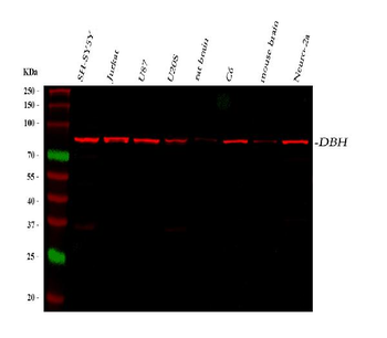 Dopamine beta Hydroxylase/DBH Antibody