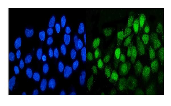 Anti-MCK10/NEP/DDR1 Antibody