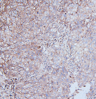 Anti-MCK10/NEP/DDR1 Antibody