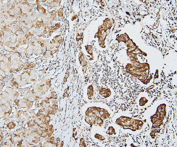 Anti-MCK10/NEP/DDR1 Antibody