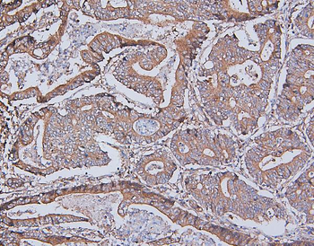 Anti-MCK10/NEP/DDR1 Antibody