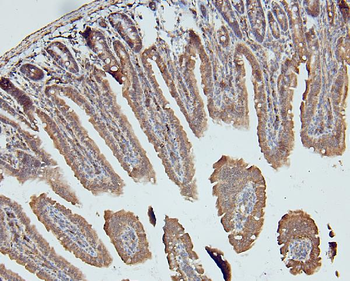 Anti-MCK10/NEP/DDR1 Antibody