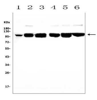 MCK10/NEP/DDR1 Antibody