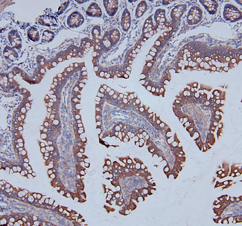 Anti-MCK10/NEP/DDR1 Antibody