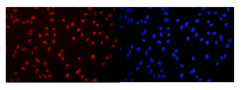 Anti-DDX5 Antibody