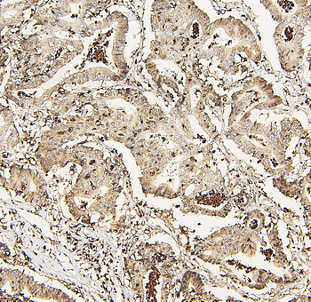 Anti-DDX5 Antibody