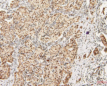 Anti-DDX5 Antibody