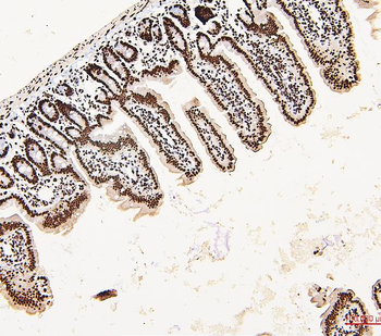 Anti-DDX5 Antibody