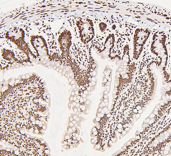 Anti-DDX5 Antibody