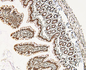 Anti-DDX5 Antibody
