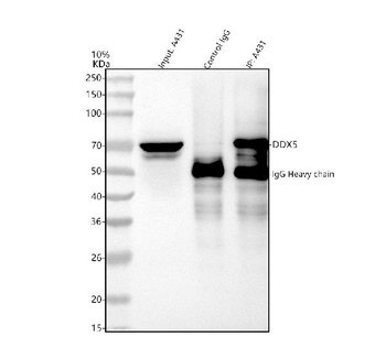 Anti-DDX5 Antibody