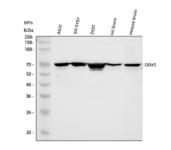 Anti-DDX5 Antibody