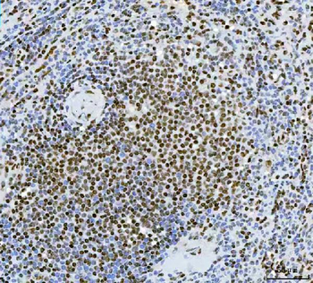 Anti-Exonuclease 1/EXO1 Antibody